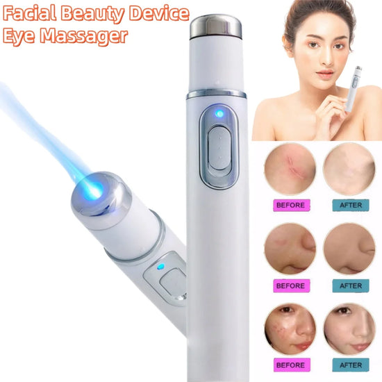 1pc Blue Light Black Eye Circles Facial Care Tool Facial Beauty Device Eye Massager Lightening Texture Maintaining Eye Bags